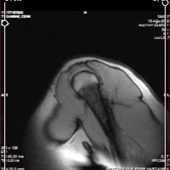 Aksigorta Ödememek İçin Poliçemi Her Türlü Bahaneyi Üretiyor