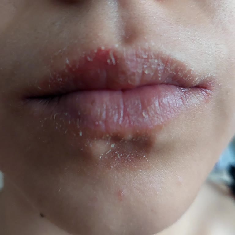 Maruderm Yüz Yıkama Jeli