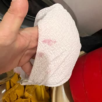 Ace Çamaşır Suyu Pembe Leke Yapıyor!