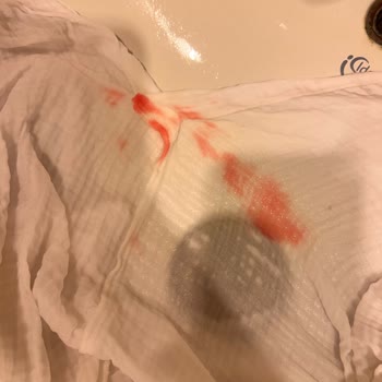 Ace Çamaşır Suyu Pembe Leke Yapıyor!