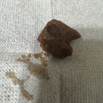 Nadir Avcan Petrol Çiğköfteden Kıl Ve Çürük Çıktı.