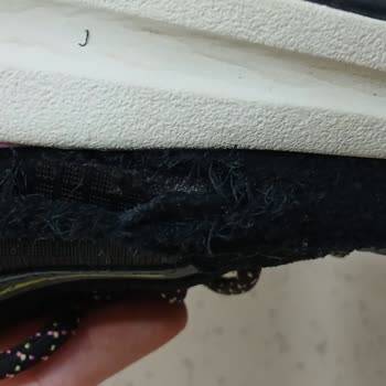 Skechers Yandan Patlama Şikayeti!