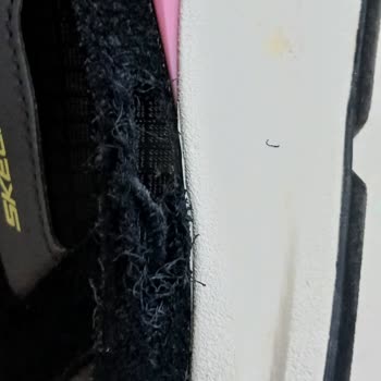 Skechers Yandan Patlama Şikayeti!