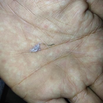 Temiz Ev Grup İstanbul - Kanarya Kötü Halı Yıkama