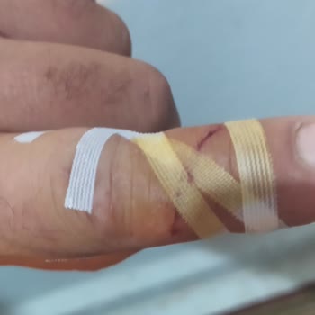 Gratis Solingen Marka Topuk Rendesi Parmağımı Kopartacaktı