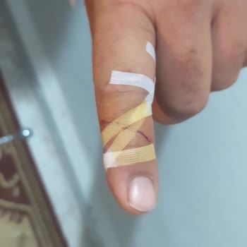 Gratis Solingen Marka Topuk Rendesi Parmağımı Kopartacaktı