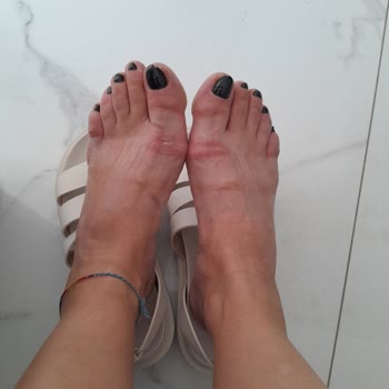 Deichmann Ayaklarımı Yara Yaptı