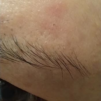 Havuzdaki Kimyasallar Her Şeyi Yaktı - Bizimtepe Aydos Evleri