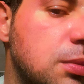 Nivea Care Canlandırıcı Yüz Temizleme Jeli Yüzümü Yaktı Ve Kızarttı