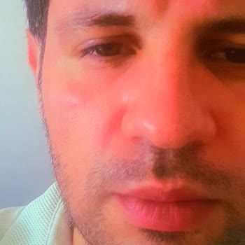 Nivea Care Canlandırıcı Yüz Temizleme Jeli Yüzümü Yaktı Ve Kızarttı