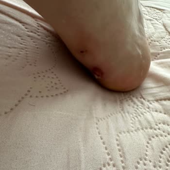 Skechers Ayakkabı Vurma Problemi