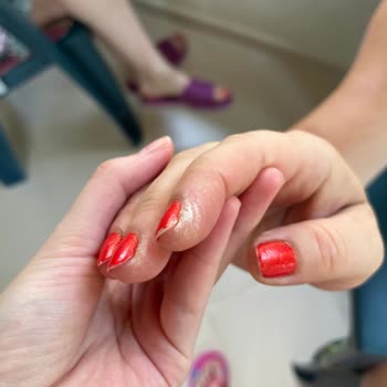 Rossmann Pink Ellerimi Yaktı