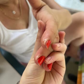 Rossmann Pink Ellerimi Yaktı