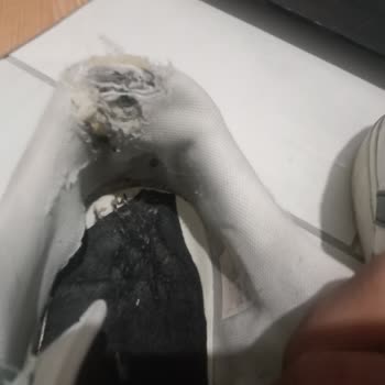 adidas Ayakkabı Yırtılmasından Dolayı Yapılan Şikayet