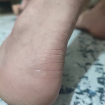 In Street Kötü Marka Krampon Deneyimim.