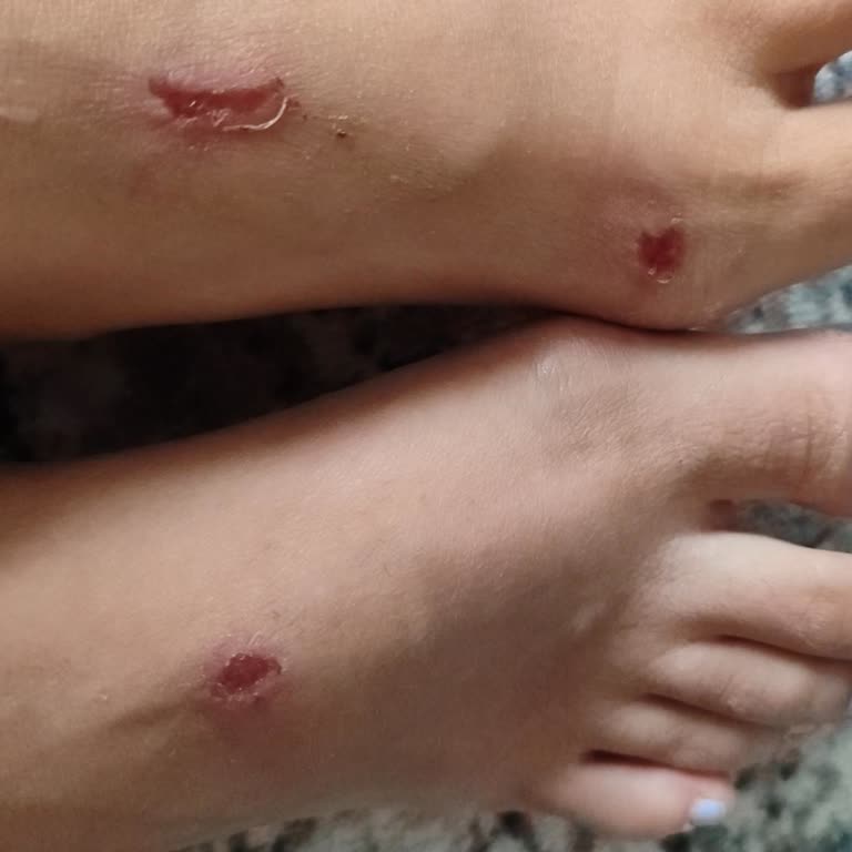 Nişantaşı Shoes İadeyi Geri Gönderdiler Şikayetçiyim