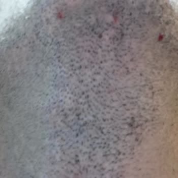 PHILIPS Ev Aletleri Philips 15arda Tıraş Makinesi Mg/7950 Kesmiyor Takılıyor Tahriş Ediyor