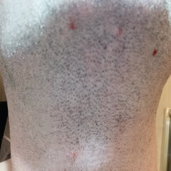 PHILIPS Ev Aletleri Philips 15arda Tıraş Makinesi Mg/7950 Kesmiyor Takılıyor Tahriş Ediyor