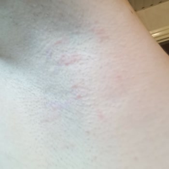 PHILIPS Ev Aletleri Philips 15arda Tıraş Makinesi Mg/7950 Kesmiyor Takılıyor Tahriş Ediyor