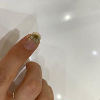 İrem Suna Nail Studio Memnuniyetsizliği