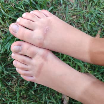 Slipstop Kaydırmaz Havuz Ayakkabısı