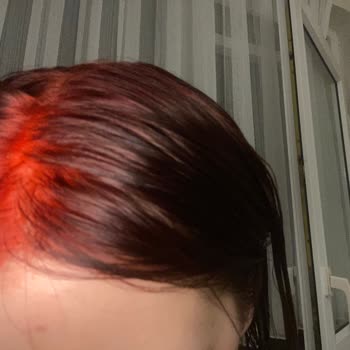 Palette Saç Boyası Kafa Derimi Yaktı