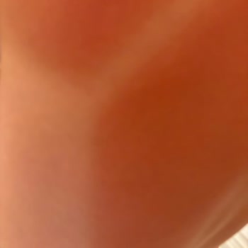 Sebamed Güneş Kremi Fiyaskosu