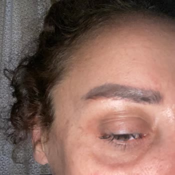 Estesecret's Clinic Klinik Deneyimi Hakkında Görüşler