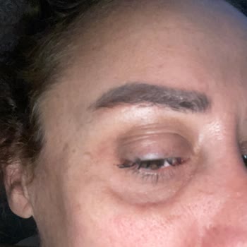 Estesecret's Clinic Klinik Deneyimi Hakkında Görüşler