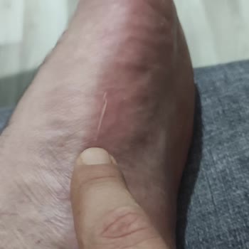 Twigy Terlikte Yaşadığım Rahatsızlık Ve Müşteri Hizmetleri Sorunu