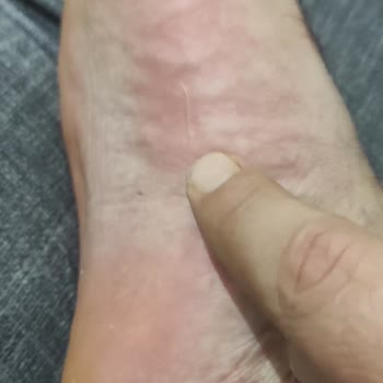 Twigy Terlikte Yaşadığım Rahatsızlık Ve Müşteri Hizmetleri Sorunu