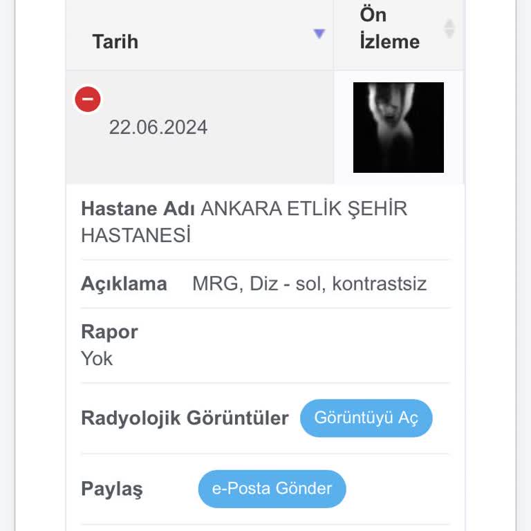 Etlik Şehir Hastanesi'nde MR Sonuçları İçin Bekleyiş