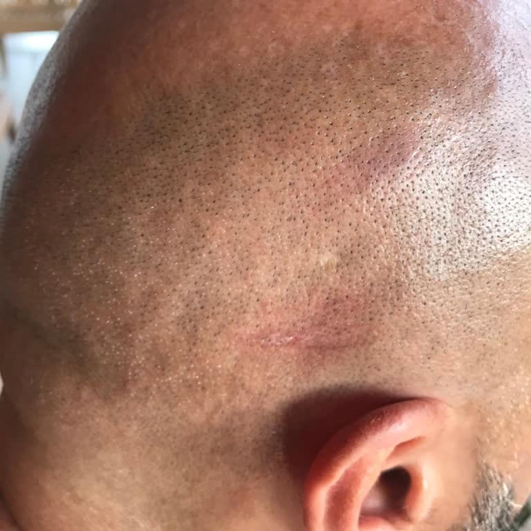 Adaland Aquapark Asla Adaland E Gitmem Bir Daha