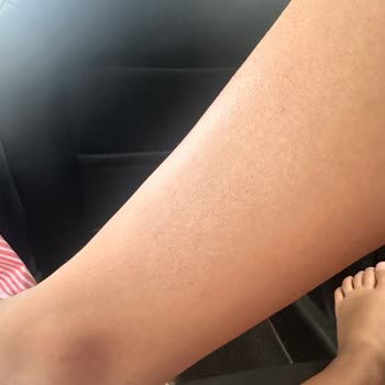 Eda Taşpınar Bomba Bronzlaştırıcı Şikayet