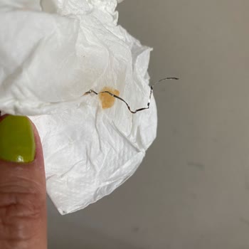 Popeyes Burger İçinden Metal Tel Çıktı.