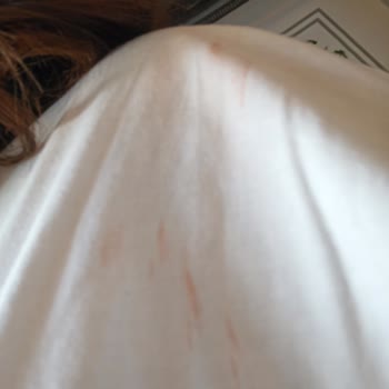 Didos Bag Kusurlu Ürünümle İlgili Problemime Kayıtsız Kalındı