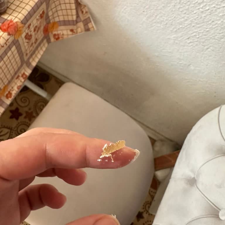 Aptamil Prosyneo 1 İçinden Çıkan Pis Kokulu Yabancı Madde