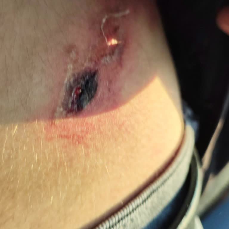 Etimesgut Şehit Sait Ertürk Devlet Hastanesi Kazazedeye Rapor Verilmedi