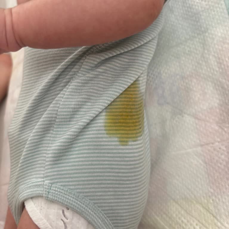 Prima Premium Care Bez Taşırma Sorunu