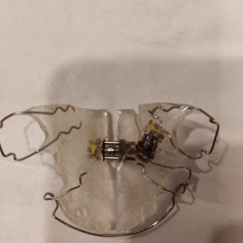 Ultra Diş Deposu Ürün Kalitesizliği