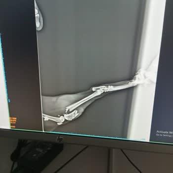 Selçuklu Belediyesi (Konya) Hız Düşürme Tümseği