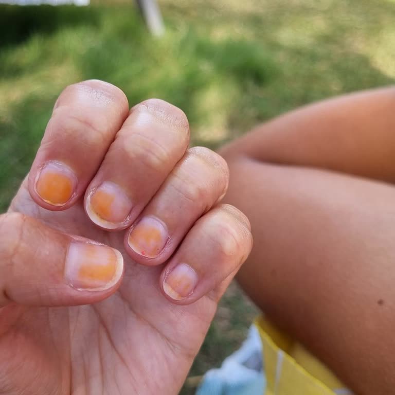 Flormar Quickdry Oje Tırnakta Kalıcı Lekeler Bıraktı