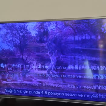 Grundig Televizyon Roma 49" Gcu 7905A 3 Yılda Bozuldu