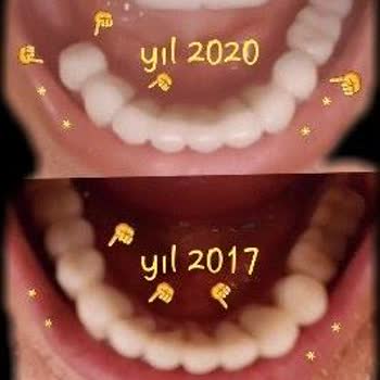 Dentaltermin Yanıltıcı Diş Kaplama Hizmeti Ve Haksız Dava
