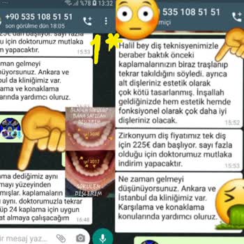 Dentaltermin Yanıltıcı Diş Kaplama Hizmeti Ve Haksız Dava