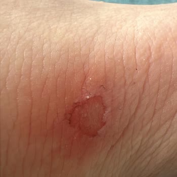 MRC Krampon Ayağa Vuran Ayakkabı