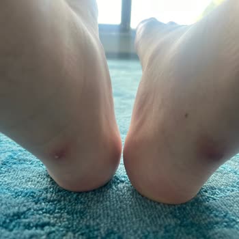 MRC Krampon Ayağa Vuran Ayakkabı