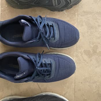 Oturduğu Yerden Yorum Yapan Skechers Uzmanı