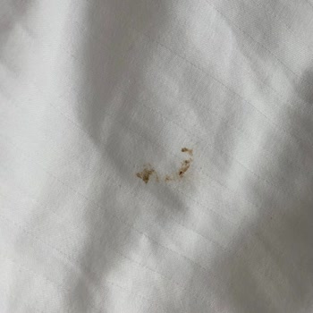 The X Belek Güvenlik Ve Yemek