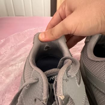 Skechers Ayakkabı Kalitesizliği Ve Müşteri Memnuniyeti Eksikliği